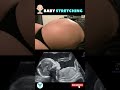 Baby stretching in moms belly  baby kicks  fetal movement shortspregnancy fitness