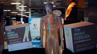 Mapping En La Semana De La Enfermedad Venosa Animaco Ón Favaloro