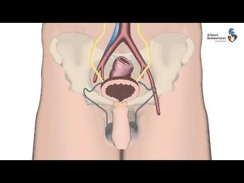 Video: Nierstenen Verpletteren - Is Er Een Veilige Methode?