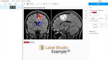 Label Studio - Demonstration labelling brain glioma