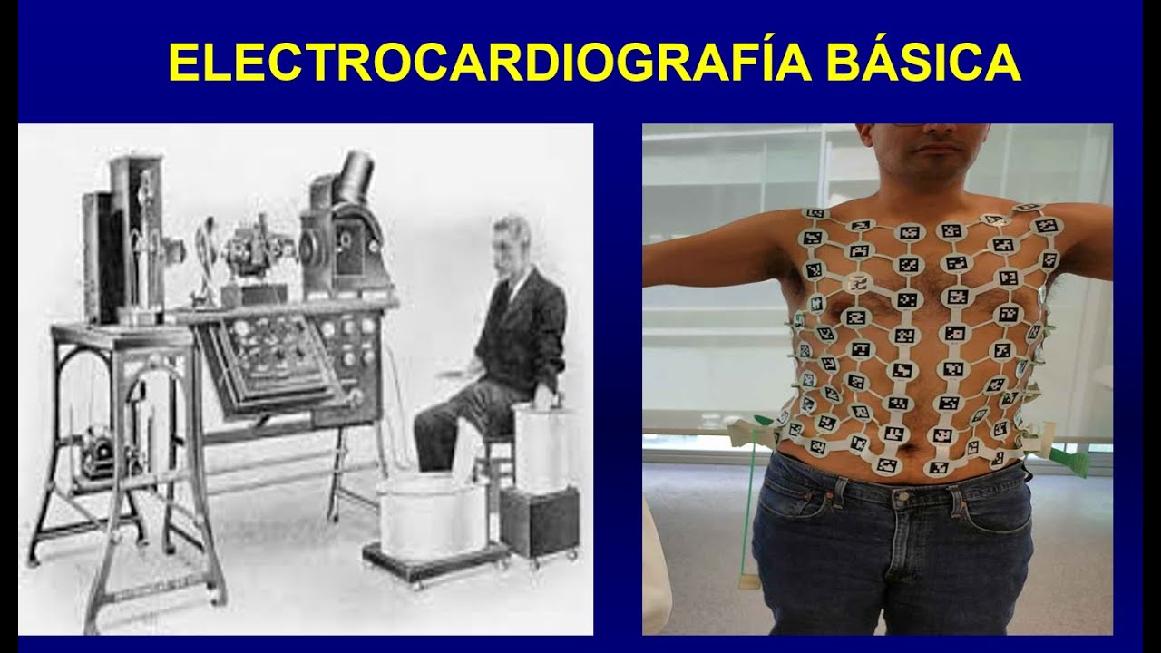 EKG normal | Dr. Chaner Zumaeta - Cardiólogo