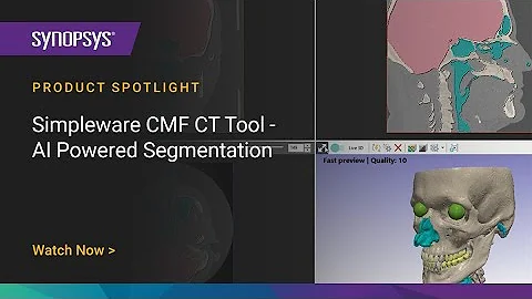 Simpleware CMF CT Tool - AI-Powered Segmentation | Synopsys