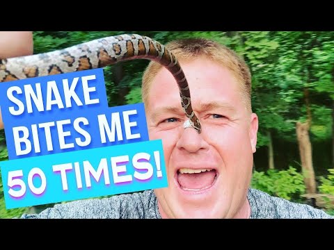 SNAKE BITES ME 50 TIMES!