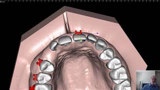 Several concepts of orthodontic bracketing.