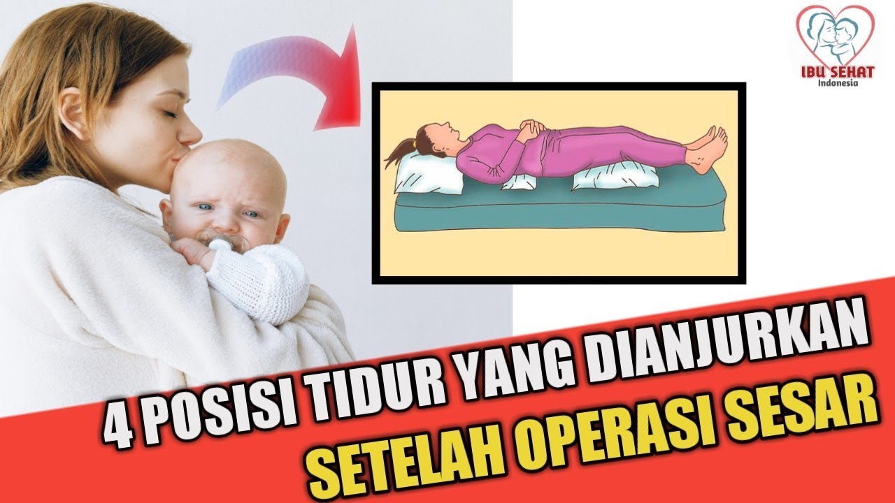 4 Posisi Tidur yang di rekomendasikan setelah melahirkan Sesar