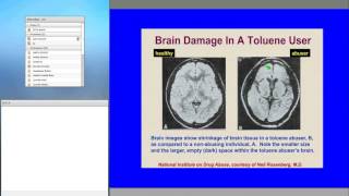 Inhalants and Club Drugs: Not Just for the Young | PrimaryCareMatters OnDemand Webinar