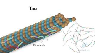Tyrosine phosphorylation is key to preventing Tau tangles in neurodegenerative diseases