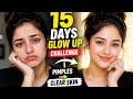 15 Days Glow Up Challenge 😱 | Pimples to Clear Skin Transformation | Real Results