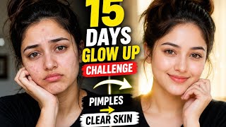 15 Days Glow Up Challenge 😱 | Pimples to Clear Skin Transformation | Real Results
