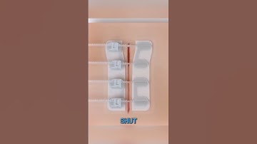 Revolutionary Bandage Closes Wounds Without Stitches