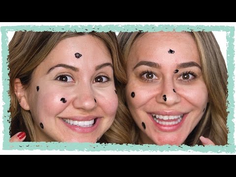 DIY Acne Spot Treatment - Bye Bye Pimples!