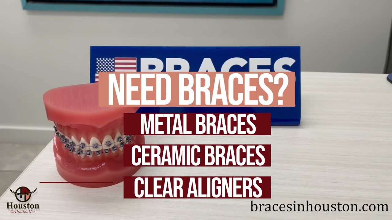 Different Types of Braces | Houston Orthodontics