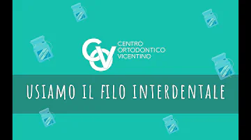 Come utilizzare il filo interdentale, anche con apparecchio