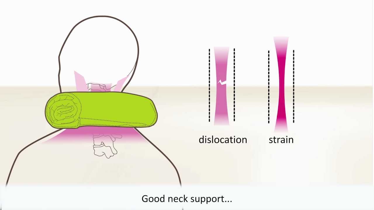 Whiplash - Symptoms And Treatment