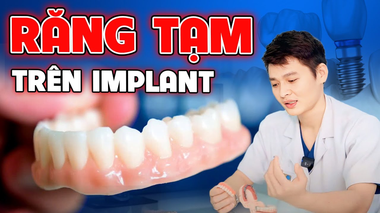 Outline Video Răng Tạm Trên Implant Có Tác Dụng Gì? Trường Hợp Nên và Không Nên Dùng Răng Tạm Trên Implant