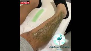Depilación Piernas Con Cera Hombre