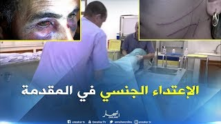 طب شرعي/ أزيد من 18 ألف عملية تشريح سنويا..والإعتداء الجنسي يتصدر القائمة