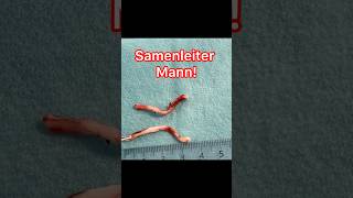 So sehen Samenleiter wirklich aus | Vasektomie erklärt