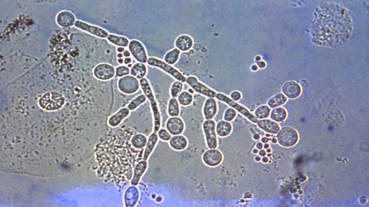 Fungal Pathogens Part 1 of 2 - YouTube