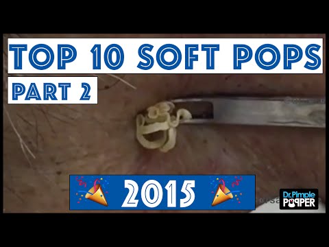 My Top 10 BEST Blackhead Pops Of 2015: Part 2, #1-#3