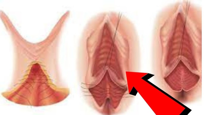 Erkak jinsiy olatni vaginada