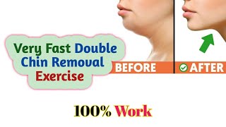 Double Chin Removal। Double Chin Exercises। How to Get Rid of Double Chin। How to Remove Face Fat।