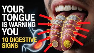 10 Tongue Changes Linked to Digestive Problems