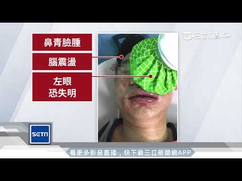 抱怨「洗澡洗太久」　彰化男遭圍毆恐瞎│三立新聞台