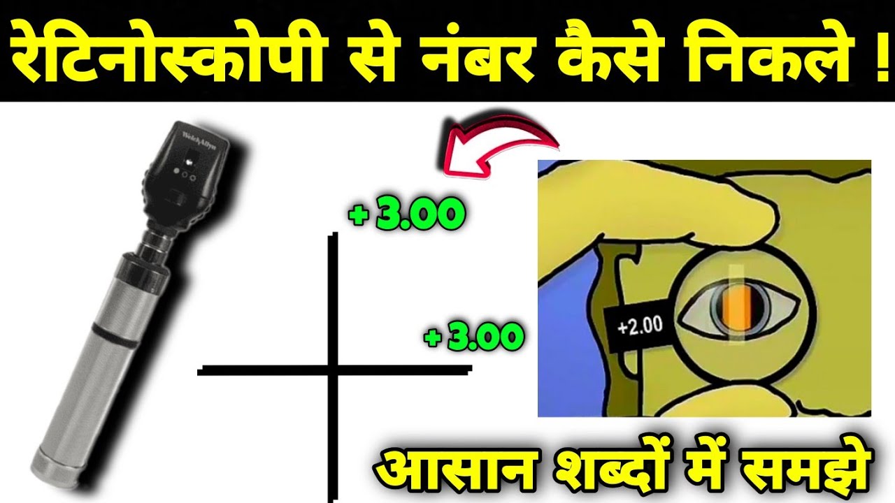 Retinoscopy se number kaise nikale/Retinoscopy, Retinoscopy in hindi