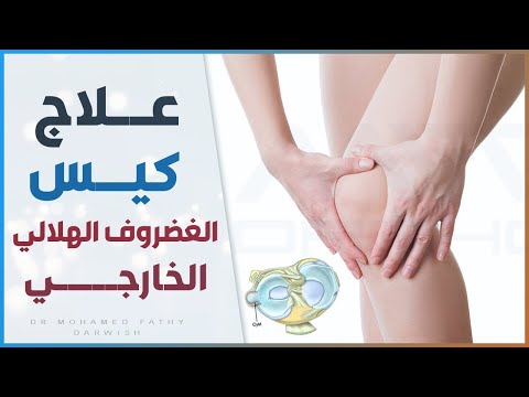 فيديو: ما هو كيس تحت الغضروف؟