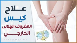 أمراض الركبة : كيس الغضروف الهلالي وعلاجه  | د. محمد فتحي درويش