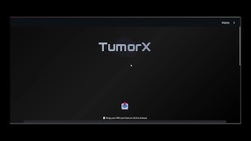 Building a Brain Tumor Detection Using Deep Learning | MRI Images Detection Using Computer Vision