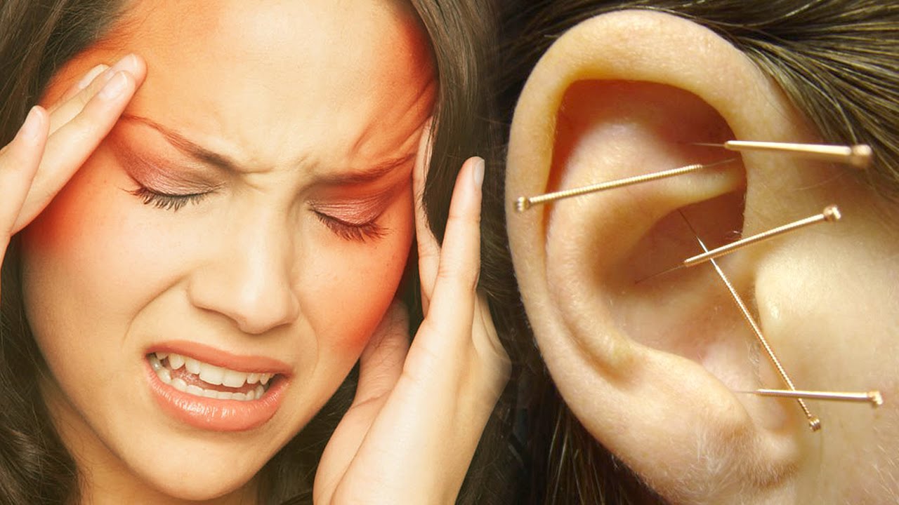 Puntos para dolor de cabeza - Auriculoterapia - YouTube
