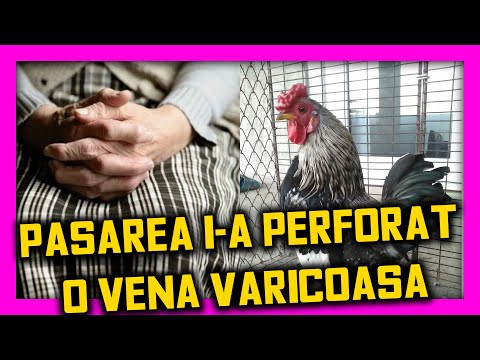 O femeie a murit după ce a fost atacată de cocoşul ei Ce spun experţii