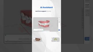 Titan Features Part 3! #clearaligners #ortho #dentalartistry #orthodontics #orthodontist #dental