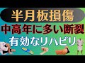 【注意】半月板損傷 中高年に特徴的な損傷と有効なリハビリ方法