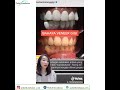 Informasi mengenai veneer gigi #shorts