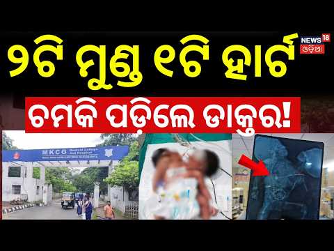 ବ୍ରହ୍ମପୁରରେ ଅଦ୍ଭୁତ ଶିଶୁ ଜନ୍ମ ! Two Headed Baby Born In Berhampur MKCG College | Medical Science