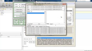 2 fMRI SPM realignment