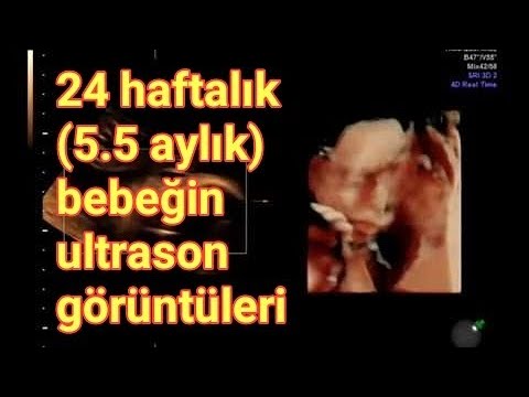 24. gebelik haftası (5.5 aylık gebelik): bebeğin 4d ultrasonografi görüntüleri