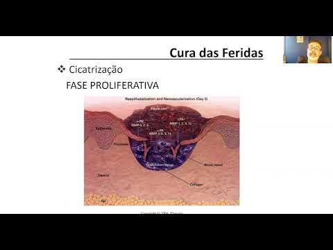 Cura das Feridas pt 1