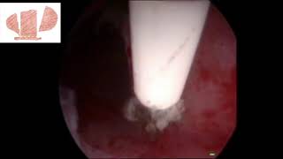 Oronzo Ceci-4