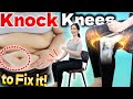 Knocking Knees 100 times a Day Secrets Rejuvenating Hormones to Prevent Diabetes and Lose Weight