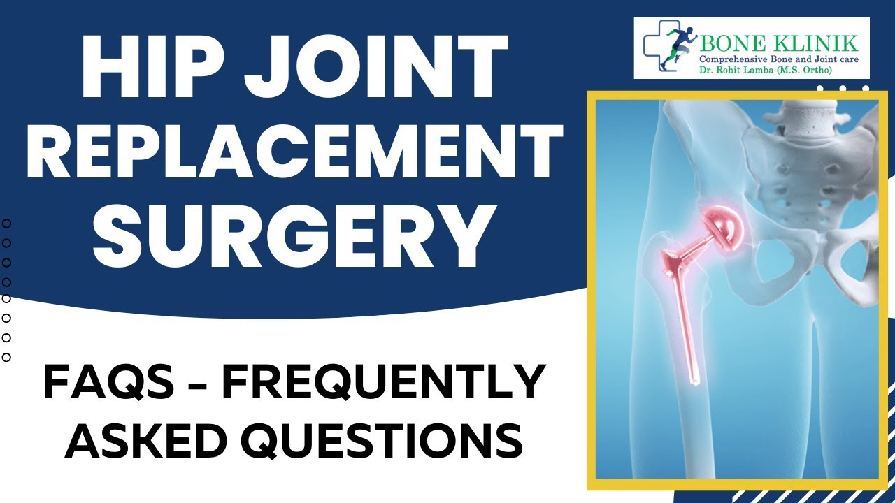 What is Hip Replacement Surgery Frequently Asked Questions (FAQs