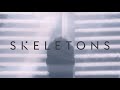 The Score - Skeletons (Official Visualizer)