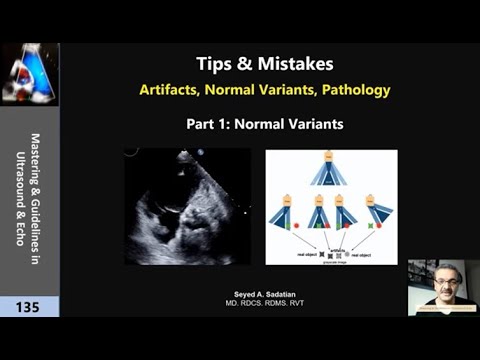 Tips & Mistakes: Artifacts, Normal Variants, Pathology part 1