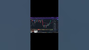 SCALPING STRATEGY 90% ACCURACY #optionstrading #stockmarket #trader #nifty #stock #trading