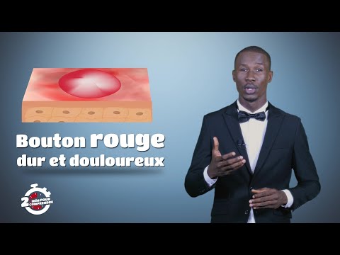 Vidéo: Pourquoi j'ai toujours des furoncles ?