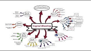 Vaginal Bleeding - OSCE
