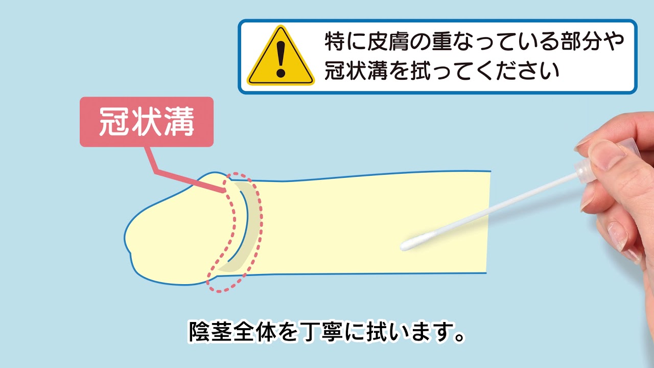 自宅で性病検査 陰茎表皮擦過物の採取方法 gme Youtube 自宅で性病検査 陰茎表皮擦過物の採取方法 gme Youtube